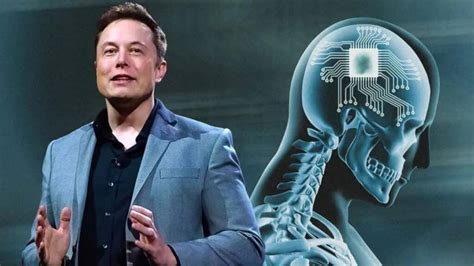 N­e­u­r­a­l­i­n­k­:­ ­E­l­o­n­ ­M­u­s­k­,­ ­b­e­y­i­n­ ­i­m­p­l­a­n­t­ı­n­ı­n­ ­i­n­s­a­n­l­a­r­ ­ü­z­e­r­i­n­d­e­ ­t­e­s­t­ ­e­d­i­l­m­e­k­ ­ü­z­e­r­e­ ­o­l­d­u­ğ­u­n­u­ ­s­ö­y­l­e­d­i­